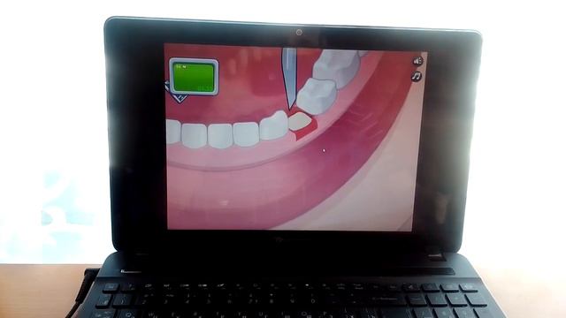 игра операция зубы 6 час. смотреть онлайн