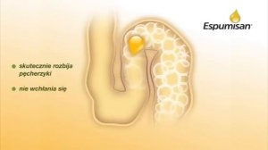 Espumisan Krople 30''