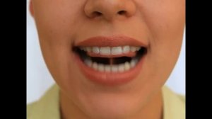 Артикуляционная гимнастика   Гармошка