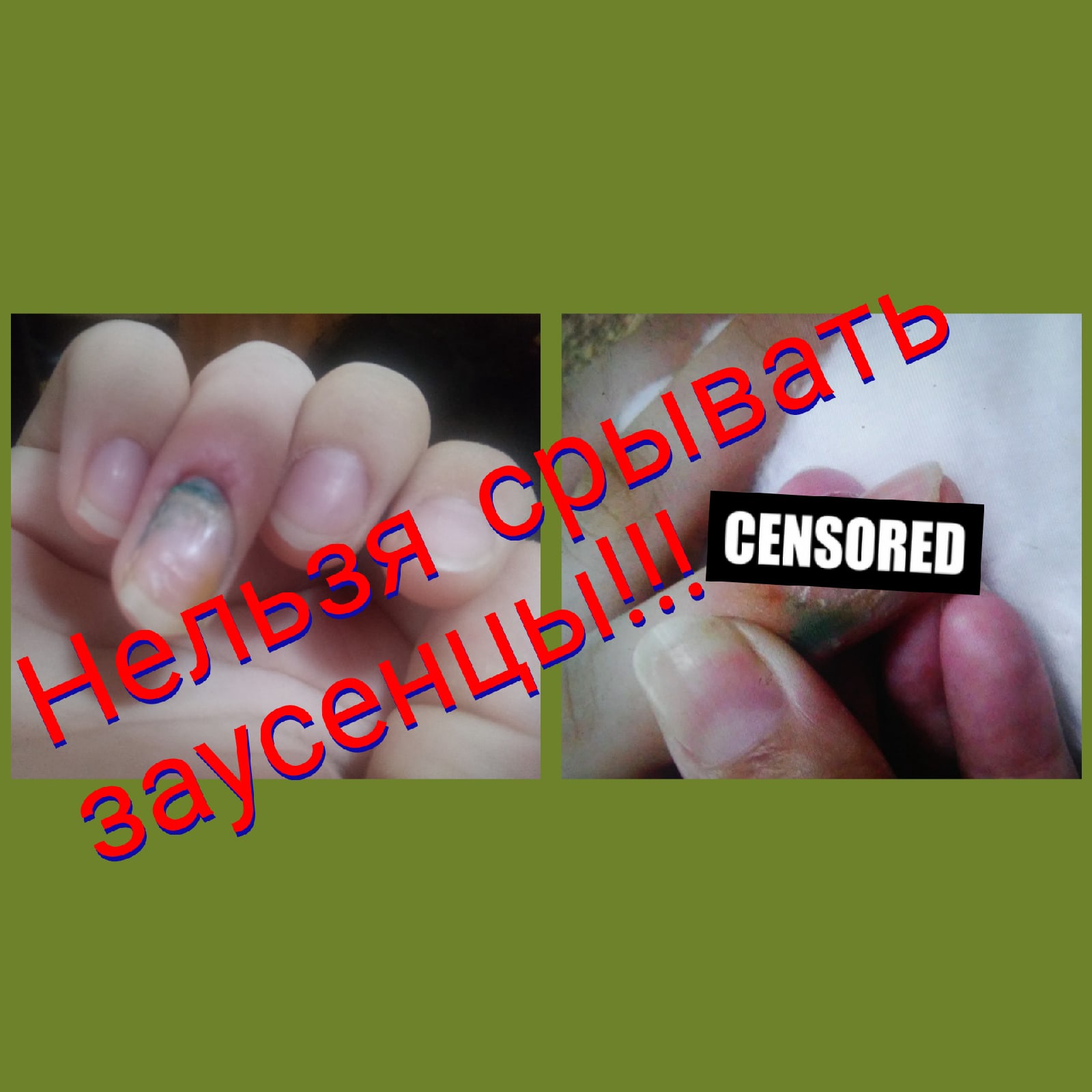 ШОК-ПАЛЬЧИК! Маникюр подростку пианисту. Ногти грызунчика..mp4