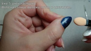 Скрученные ногти/ Как исправить Гелем/ Врастающие ногти