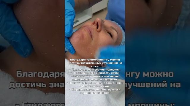 Мультикислотный пилинг. смотреть онлайн