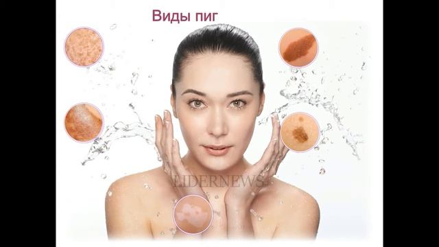 ➡️ ПИГМЕНТАЦИЯ Что такое пигментация, причины, виды смотреть онлайн