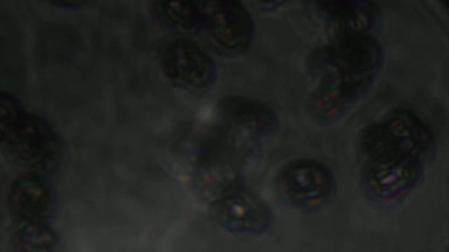 Mushroom spore up close under microscope смотреть онлайн