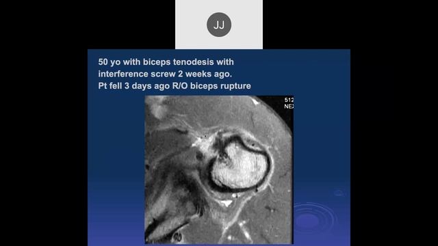 MR of the Biceps Tendon | 2023, Part 2 смотреть онлайн