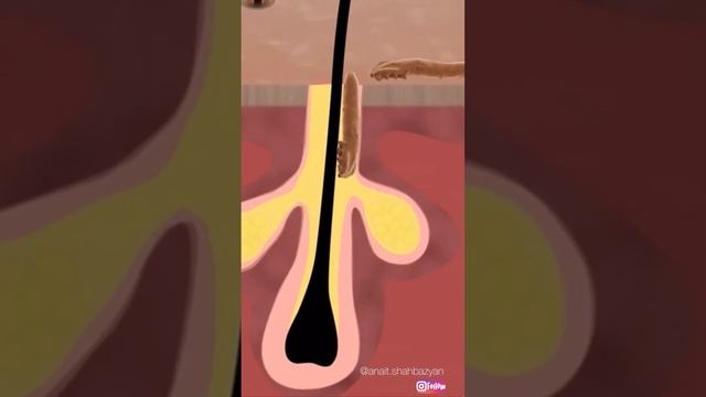 ДЕМОДЕКС | ПОДКОЖНЫЙ КЛЕЩ. СТОИТ ЛИ С НИМ БОРОТЬСЯ? Вторая часть скоро! смотреть онлайн