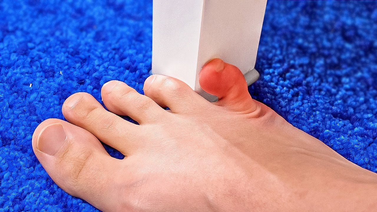 ЛАЙФХАКИ ДЛЯ ПЕРВОЙ ПОМОЩИ || 23 БЕЗОПАСНЫХ ТРЮКА ПРОТИВ РАСПРОСТРАНЕННЫХ ПРОБЛЕМ