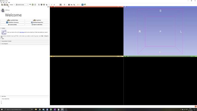 3D Slicer Tutorial #1: Basics смотреть онлайн
