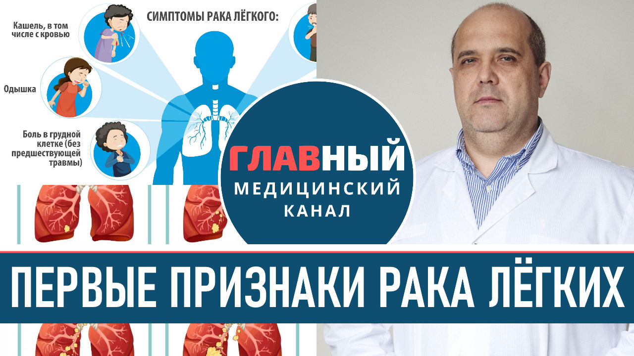 Симптомы Рака Легких. Признаки как определить рак лёгкого на 1-4 стадии смотреть онлайн