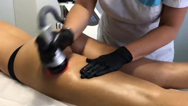 Вакуумный RF ?массаж смотреть онлайн