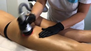 Вакуумный RF ?массаж