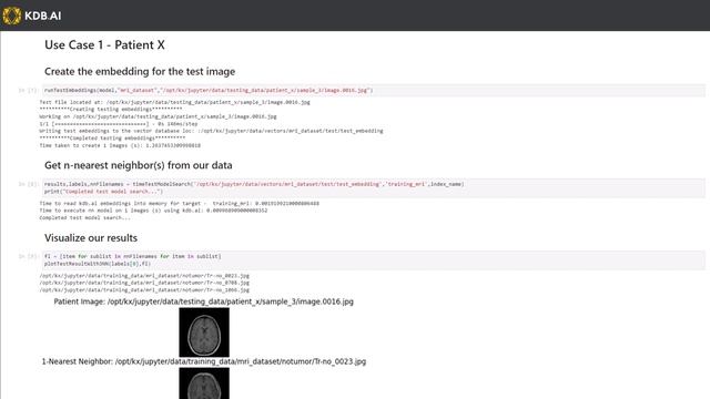 Image Similarity Search with KDB.AI Vector Embeddings смотреть онлайн