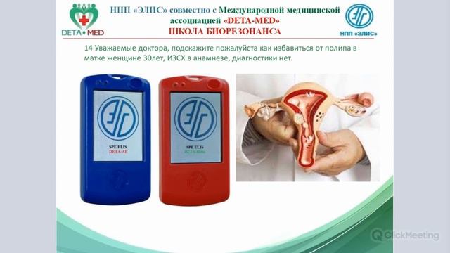 ПОЛИП МАТКИ смотреть онлайн