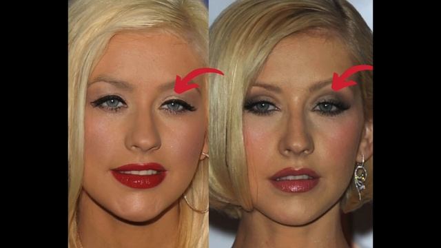 Christina Aguilera: Plastic Surgery (2002-2020)
