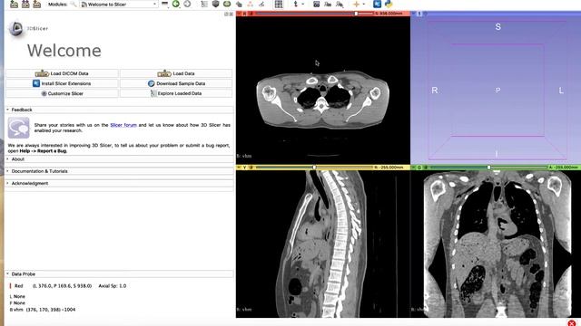 Slicer Load Data смотреть онлайн