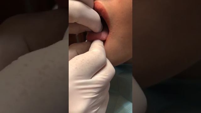 Обычный прокол языка и прокол кончика языка смотреть онлайн