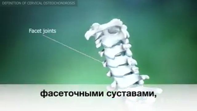 Шейный остеохондроз