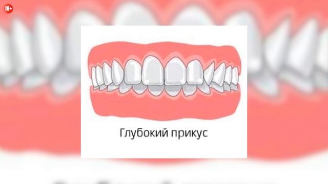 7 Фактов Зеницу Агацума смотреть онлайн