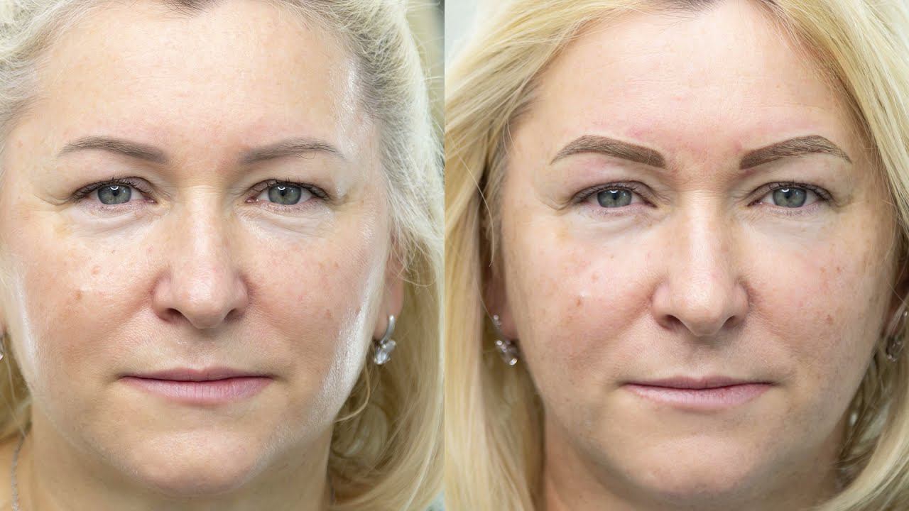 Перекрытие старого татуажа бровей😍Изменили форму и цвет🔥 смотреть онлайн