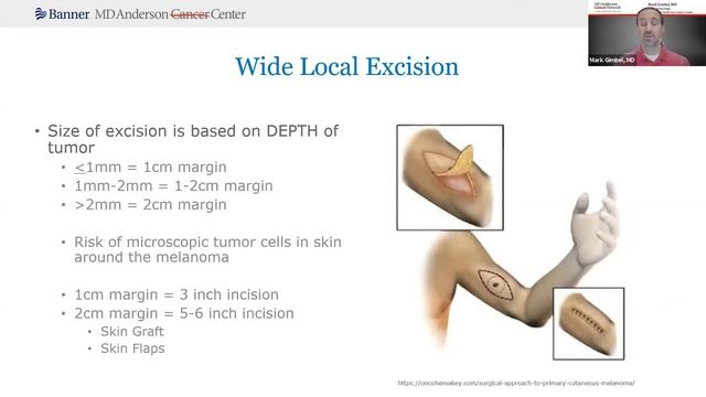 It's Melanoma, Now What? смотреть онлайн