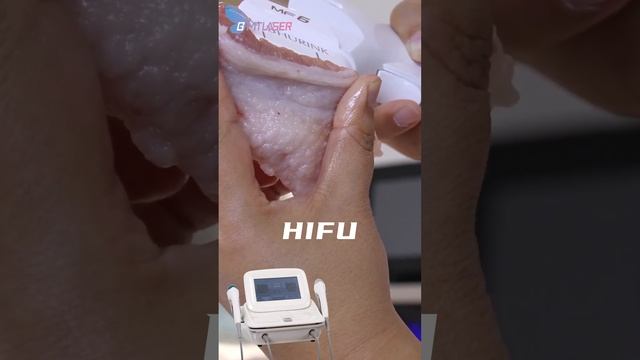 7d HIFU Anti-wrinkle anti-aging machine #hifu смотреть онлайн