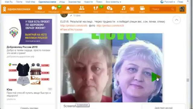 БЛАГОДАРЯ ПРОДУКТУ#ELEV8 #ACCELER8 РАСТВОРИЛИСЬ КАМНИ В ЖЕЛЧНОМ ПУЗЫРЕ! смотреть онлайн