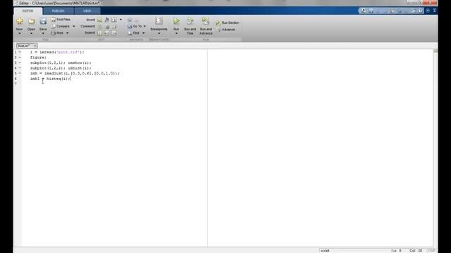 Histogram equalization and contrast stretching in Matlab смотреть онлайн