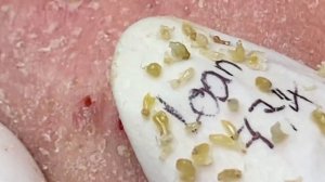 Enjoy Every Day With The Best Video Loan Nguyen Spa Official | 921