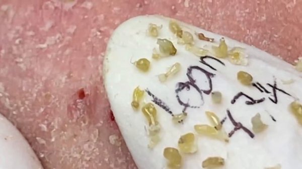 Enjoy Every Day With The Best Video Loan Nguyen Spa Official | 921