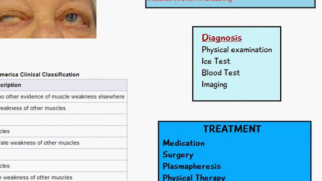 Myasthenia Gravis MADE EASY - Cause, Symptoms, Diagnosis and Treatment of MG - Animation смотреть онлайн