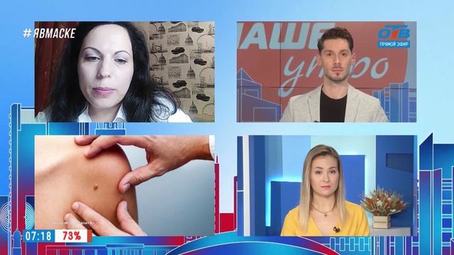 Гость на связи – можно ли удалять родинки? смотреть онлайн
