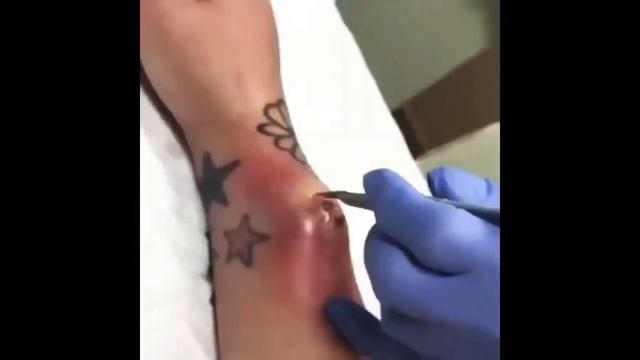 ДАВИМ ПРЫЩ! ДАВЯТ ПРЫЩИ! ЧЕРВИ В УХЕ! ГНОЙ! смотреть онлайн