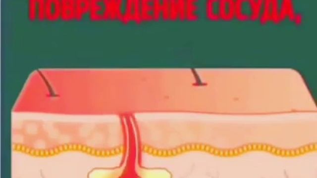 Если удалят волосы можно умреть! смотреть онлайн