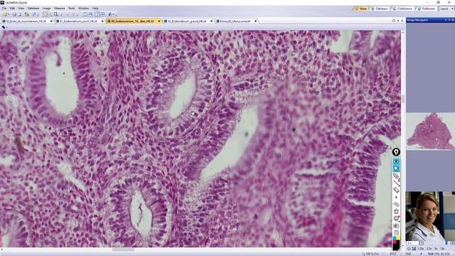 uterus (děloha) смотреть онлайн