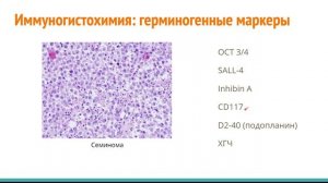 Развитие мочеполовой системы | Элементарная гистология