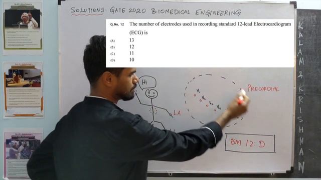 Fun ECG Question: How Many Electrodes Are There In Recording A 12 Lead ECG?