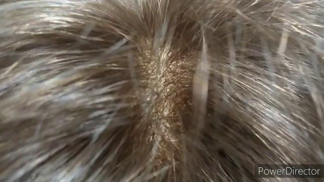 Парик из натуральных волос с эффектом кожи. Смотрится как настоящий. смотреть онлайн