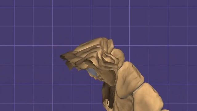 Шаповалов Альберт (стоматолог) Цифровое моделирование циркониевых коронок на зубы смотреть онлайн
