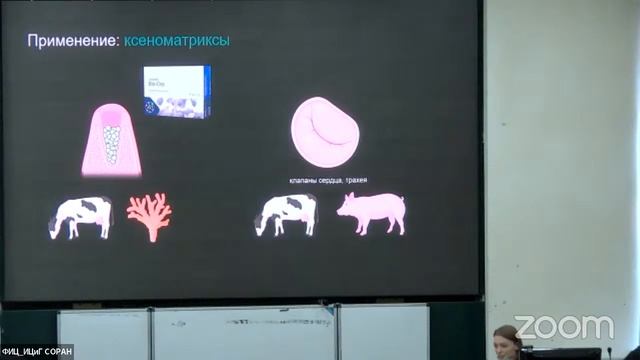 Татьяна Шнайдер ""Ксенотрансплантация" смотреть онлайн