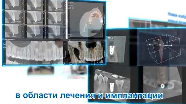Кастелини - 3D ТомографРентгеноборудование смотреть онлайн