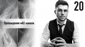 Уроки эндодонтии. Простой способ прохождения мб2-канала