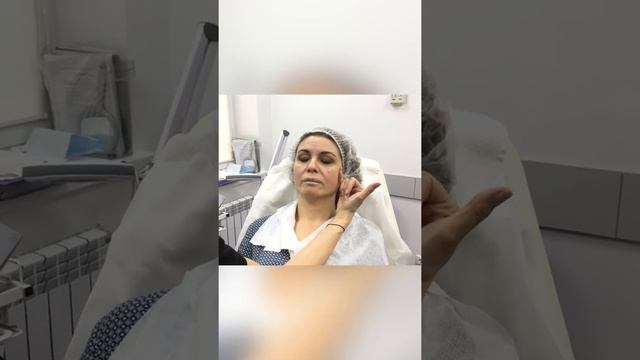 ГЛУБОКИЕ НОСОГУБКИ!!! ЧТО С НИМИ ДЕЛАТЬ?