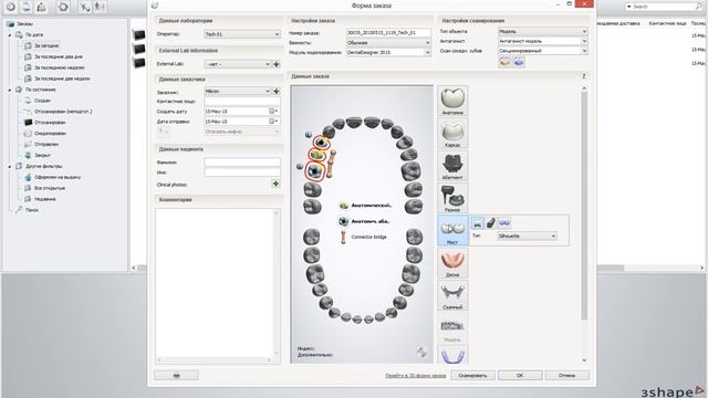 3Shape тренинг смотреть онлайн