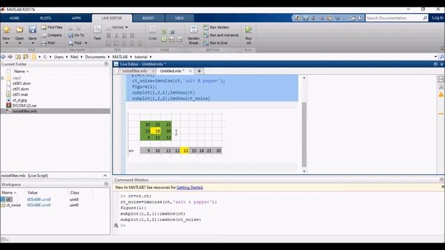 Median Filter para ruido en imágenes medicas смотреть онлайн