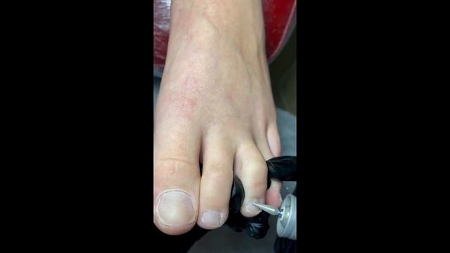 Аппаратный педикюр