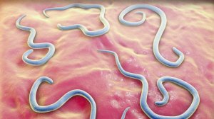 Как избавиться от паразитов, самый простой метод