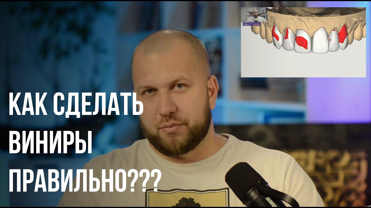 Подготовка под виниры для закрытой группы Как правильно делать waxup mockup ошибки врача и техника смотреть онлайн