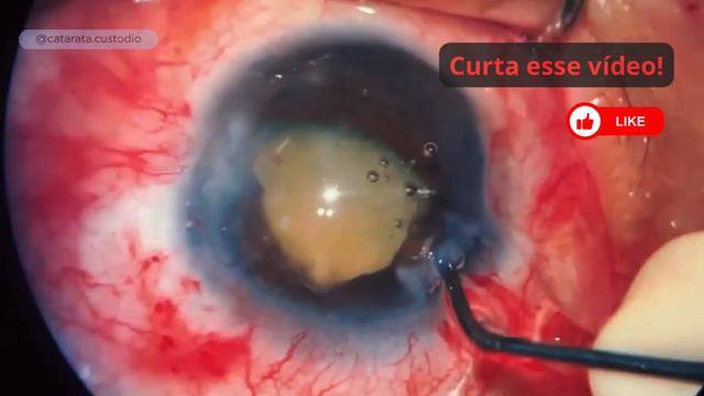SUFOCO!!! A Utrata não estava me ajudando - Como escapei desse problema смотреть онлайн