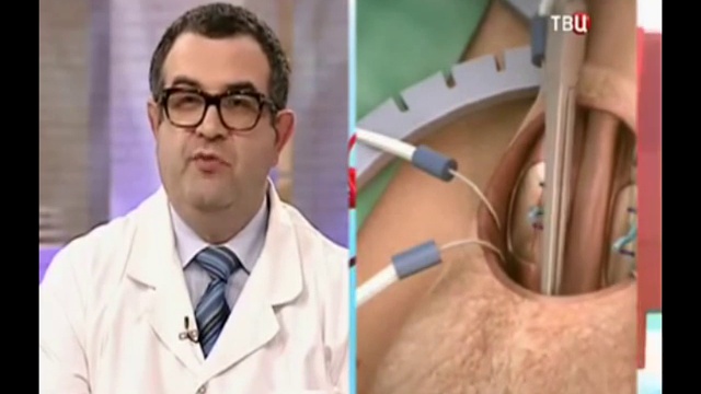 Фаллопротезирование. Лечение эректильной дисфункции.1