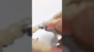 Бюгельный протезы на замках МК1